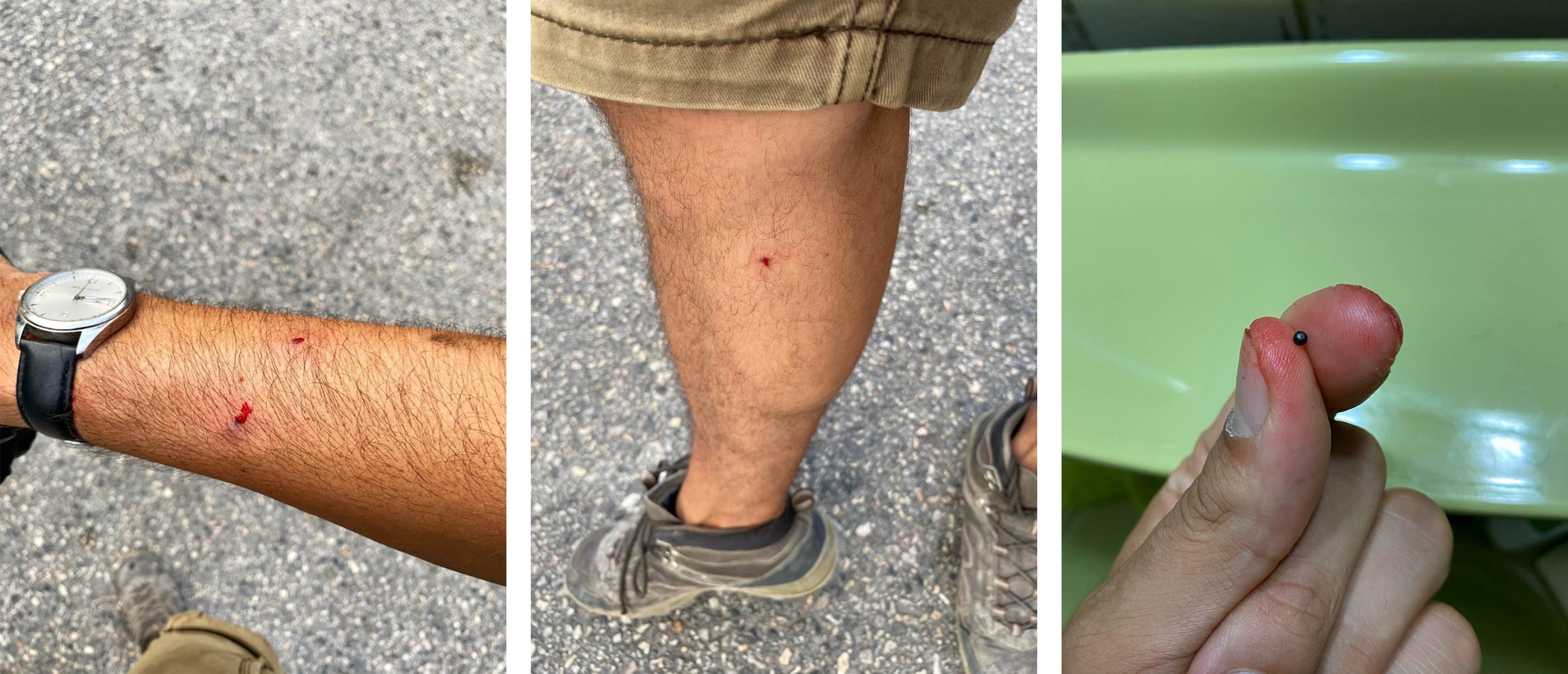 Photographer injured by metal pellets. 