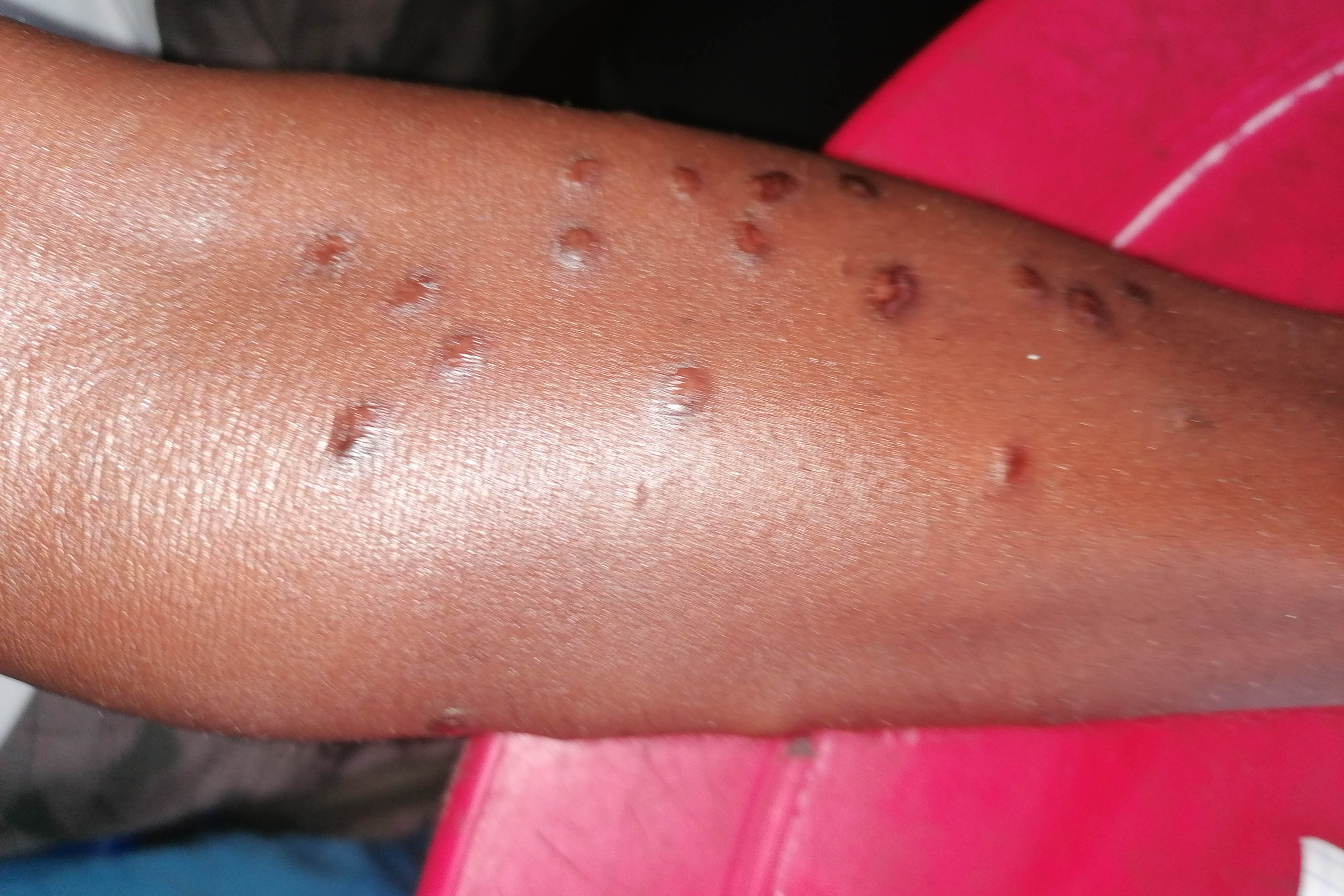 A 36-year-old Yansi motorcycle driver was attacked and wounded on September 4 by Mobondo assailants as he returned home from the village of Bethanie.