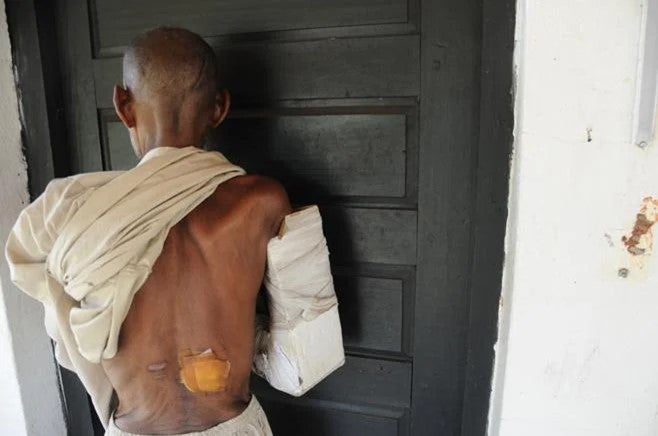 Wounds of a victim of the February 1, 2014 anti-balaka attack on Guen.