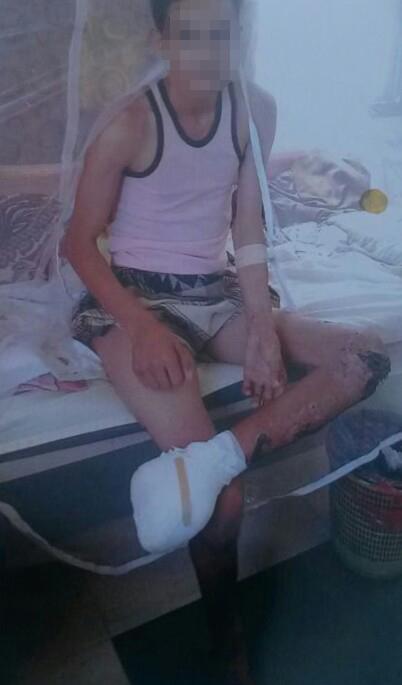 MENA ARMS Yemen Landmines Sept 2016 photo-3