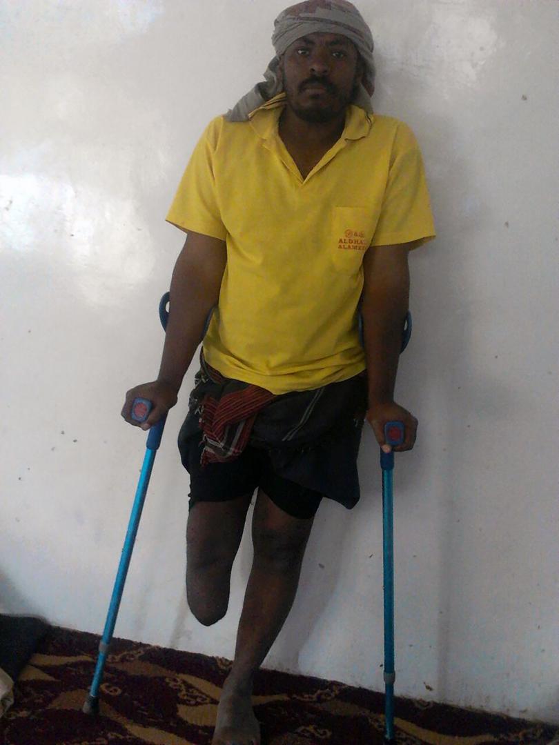 Ali al-Ansi, 35, stepped on a landmine in an orange grove where he works in Marib on March 1, 2016 after returning from a lunch break with his wife and two daughters. 
