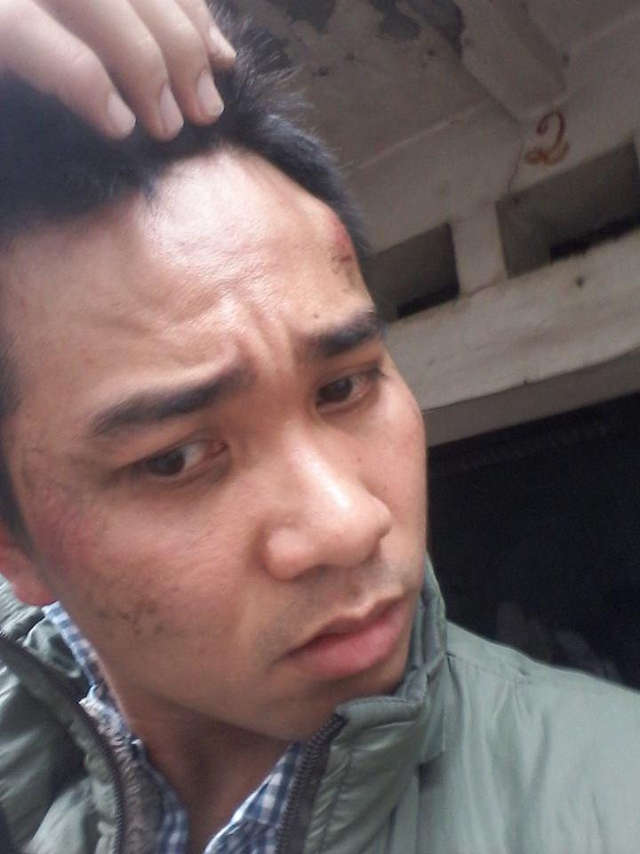Tu Anh Tu after being assaulted in Hanoi on April 8, 2016.
