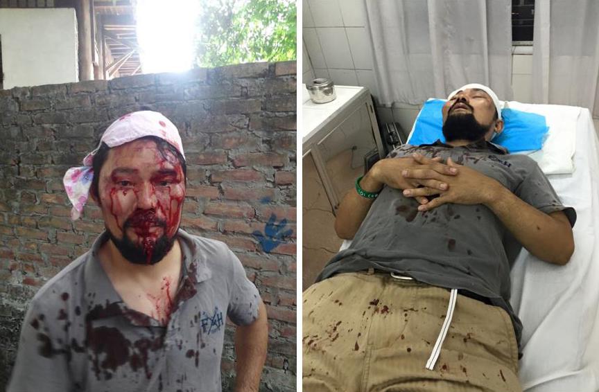 Nguyen Chi Tuyen after being assaulted in Hanoi on May 11, 2015.