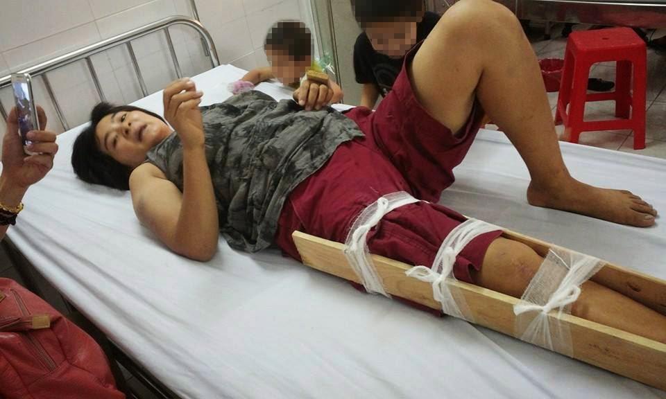 Tran Thi Nga after being assaulted in Hanoi on May 25, 2014. 