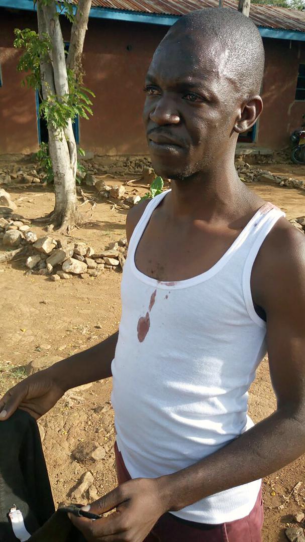 Isaiah Gwengi, mwandishi wa habari za gazeti la Standard, muda mfupi baada ya kuachiliwa huru na kikosi cha polisi cha Quick Response Team kule Siaya, magharibi mwa Kenya Mnamo tarehe 23 Machi, 2017. Inadaiwa kuwa maafisa hao walimpiga na kumgonga kwa bun