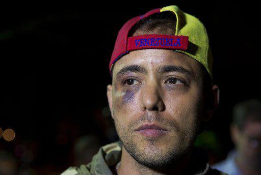 El periodista venezolano Jesús Medina habla con la prensa en Caracas, Venezuela, el martes 7 de noviembre de 2017.