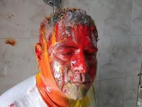 Gamal Eid after the December 29, 2019 assault in Cairo, Egypt in which he was beaten and had paint thrown at him. 