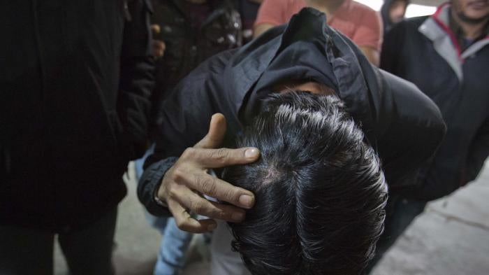 A migrant who claims he was beaten by Croatian police while attempting to cross the border to Croatia shows his injury at a factory hall turned migrants facility in Bihac, Bosnia-Herzegovina, Wednesday, March 13, 2019.