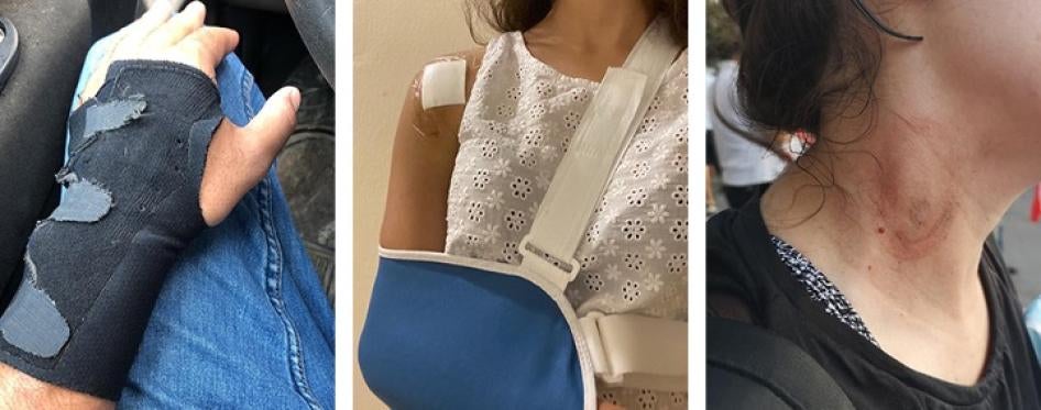 Three protesters injured by teargas cartridges fired directly at the torsos and heads. 