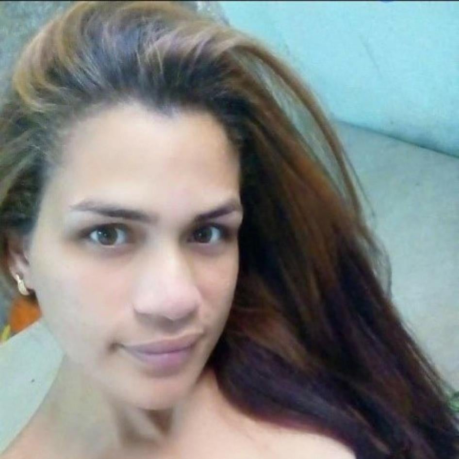 202110americas_cuba_AlizandraOmo