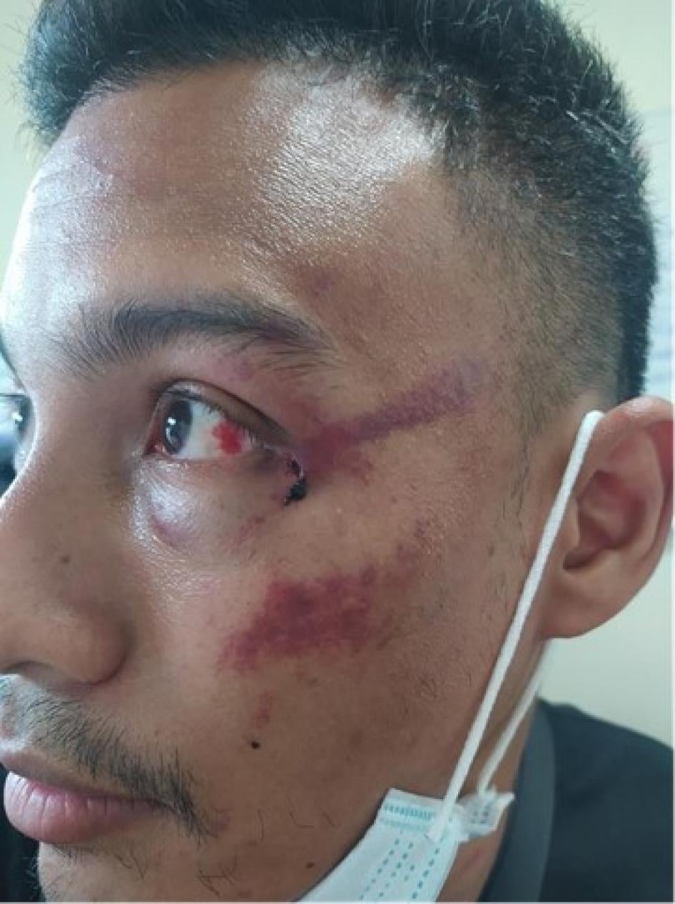 202111asia_thailand_protests_attasithnussa