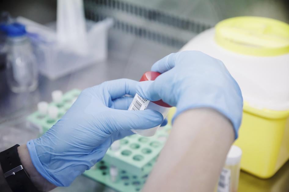 A nurse holds one of the tests for monkeypox at the Hospital Ramón y Cajal, May 30, 2022, in Madrid, Spain. © 2022 Carlos Luján/Europa Press via AP  
