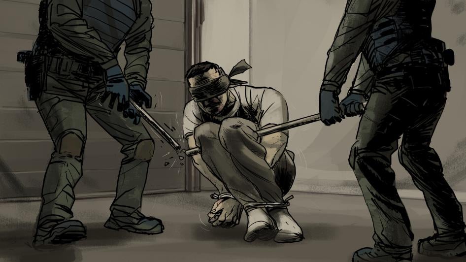 « Boghdan », détenu par les forces russes lors de leur occupation d’Izioum, en Ukraine, a déclaré que les soldats l’avaient au moins une fois forcé à adopter une variante de la « position du perroquet ». Une fois, selon son témoignage, le tuyau de métal n’a pas supporté son poids : quand les soldats l’ont soulevé, le tuyau a plié et s’est cassé. 