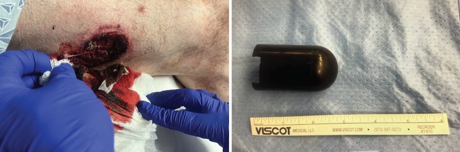 5c43f386-82c7-423f-a725-a18c6100beda