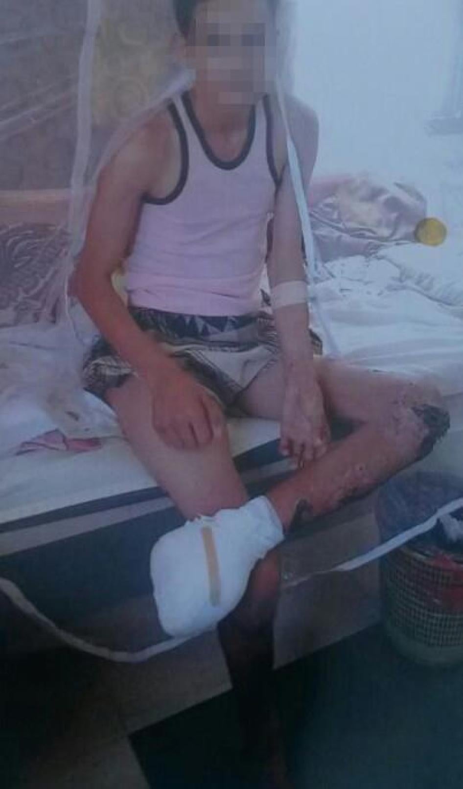 MENA ARMS Yemen Landmines Sept 2016 photo-3