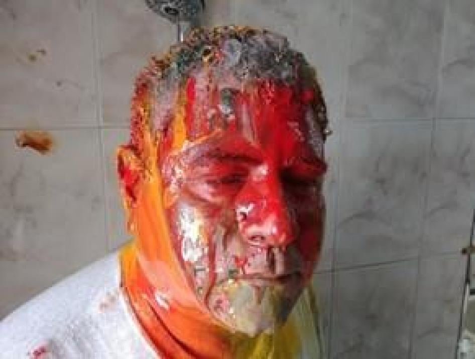 Gamal Eid after the December 29, 2019 assault in Cairo, Egypt in which he was beaten and had paint thrown at him. 