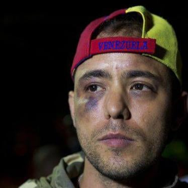 Venezuelan journalist Jesus Medina speaks with press in Caracas, Venezuela, Tuesday, Nov. 7, 2017. 