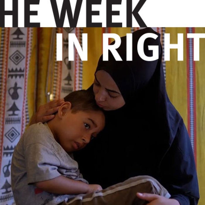 A child is held in parent's arms. 